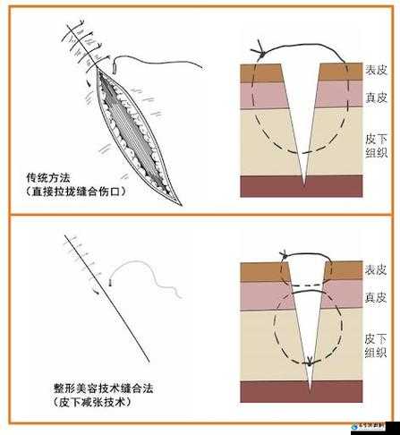 竹板打肿臂：缝合不上的意外之痛